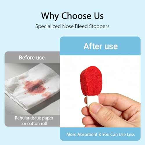 Nose Bleed Stopper Plugs for All Ages 10 Pack Compact 1.8x0.5x0.1in