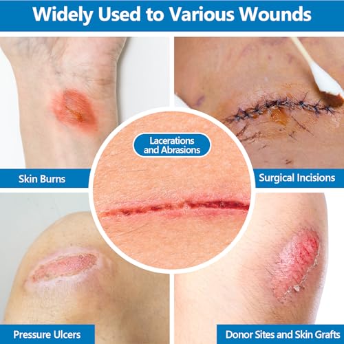 16 Pack 4x4 Inch Xeroform Petrolatum Gauze Dressings for Wound Care, Non-Adherent Mesh Pads